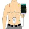 دستگاه تله مانیتورینگ قلبی - تصویر 2